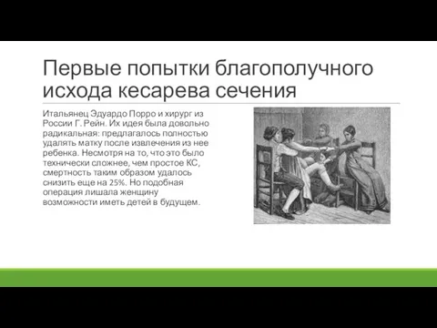 Первые попытки благополучного исхода кесарева сечения Итальянец Эдуардо Порро и хирург из