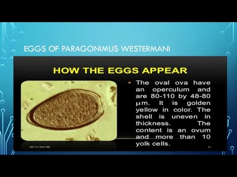 EGGS OF PARAGONIMUS WESTERMANI