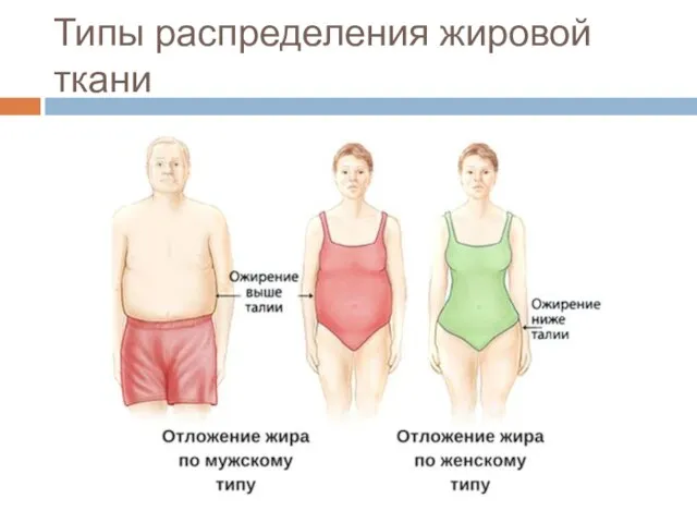 Типы распределения жировой ткани