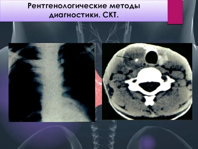 Рентгенологические методы диагностики. СКТ.