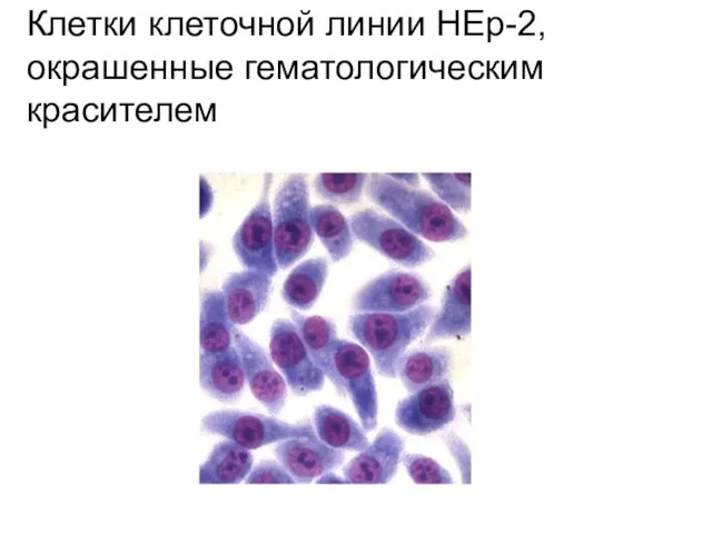 Клетки клеточной линии НЕр-2, окрашенные гематологическим красителем