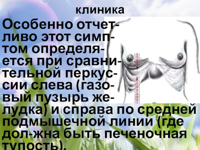 клиника Особенно отчет- ливо этот симп- том определя- ется при сравни- тельной