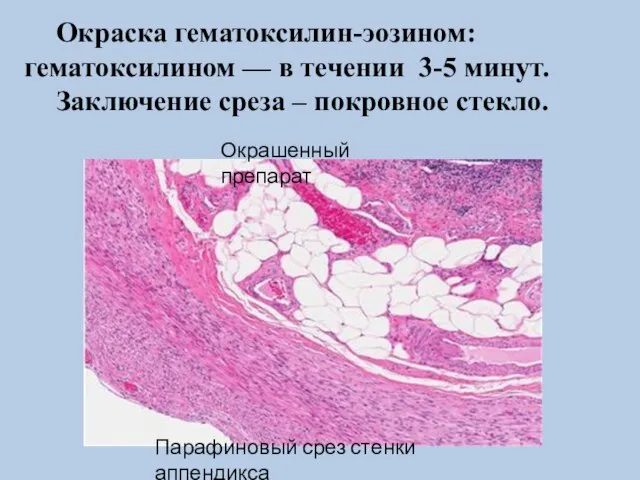 Окраска гематоксилин-эозином: гематоксилином — в течении 3-5 минут. Заключение среза – покровное