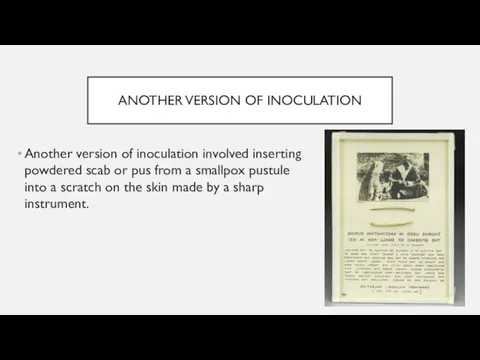 ANOTHER VERSION OF INOCULATION Another version of inoculation involved inserting powdered scab