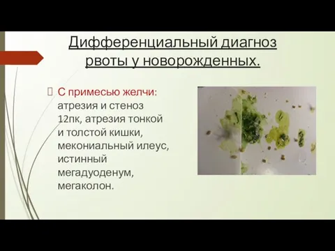 Дифференциальный диагноз рвоты у новорожденных. С примесью желчи: атрезия и стеноз 12пк,