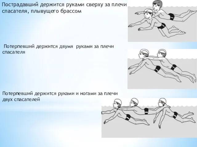 Пострадавший держится руками сверху за плечи спасателя, плывущего брассом Потерпевший держится двумя