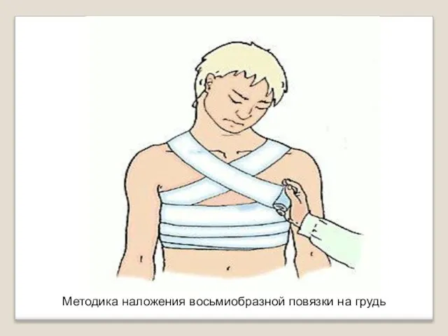 Методика наложения восьмиобразной повязки на грудь