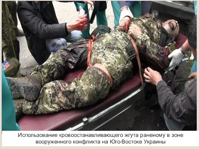 Использование кровоостанавливающего жгута раненому в зоне вооруженного конфликта на Юго-Востоке Украины