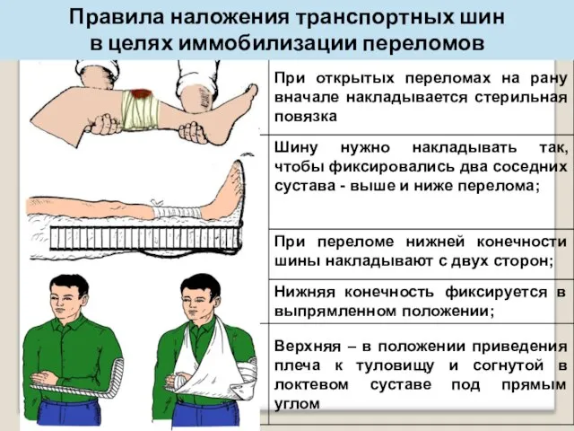 Правила наложения транспортных шин в целях иммобилизации переломов