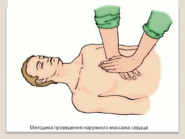 Методика проведения наружного массажа сердца