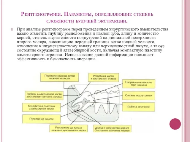 Рентгенография. Параметры, определяющие степень сложности будущей экстракции. При анализе рентгенограмм перед проведением