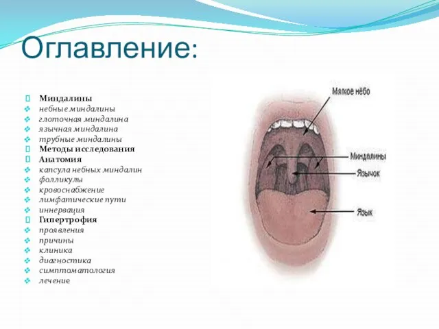 Оглавление: Миндалины небные миндалины глоточная миндалина язычная миндалина трубные миндалины Методы исследования