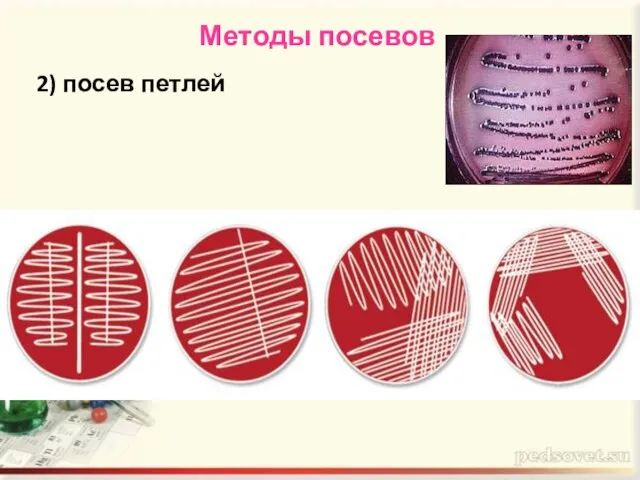 Методы посевов 2) посев петлей