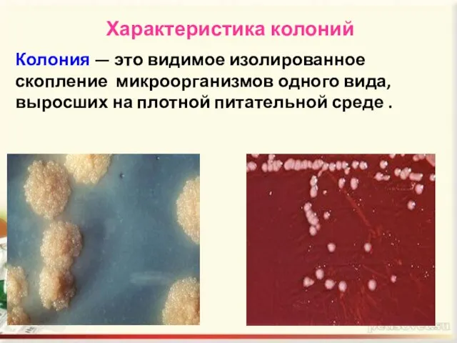 Характеристика колоний Колония — это видимое изолированное скопление микроорганизмов одного вида, выросших