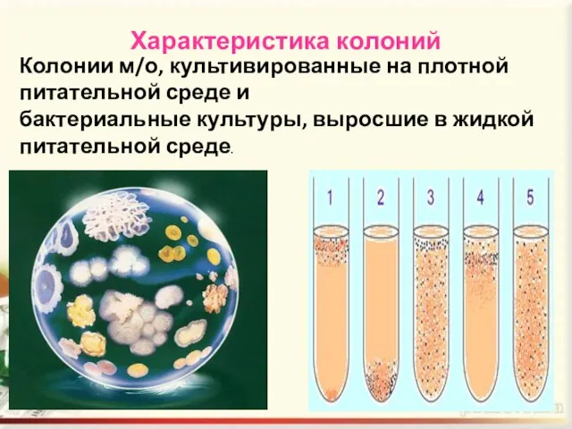 Характеристика колоний Колонии м/о, культивированные на плотной питательной среде и бактериальные культуры,