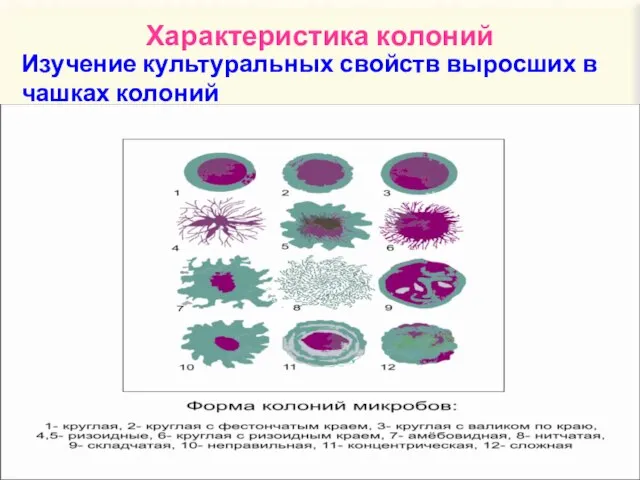 Характеристика колоний Изучение культуральных свойств выросших в чашках колоний 1. Форма колоний