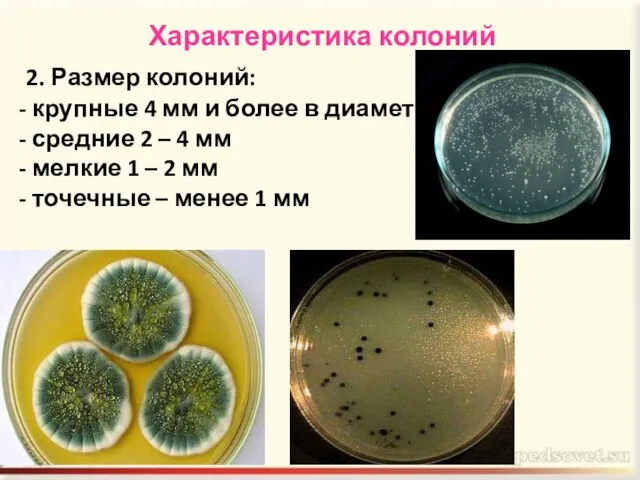 Характеристика колоний 2. Размер колоний: крупные 4 мм и более в диаметре