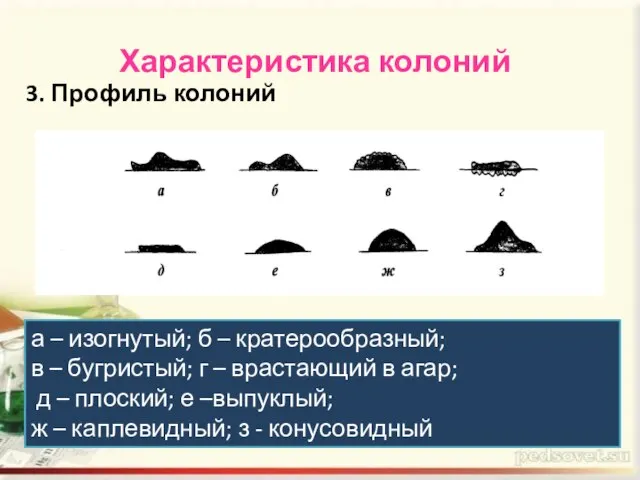 Характеристика колоний 3. Профиль колоний а – изогнутый; б – кратерообразный; в