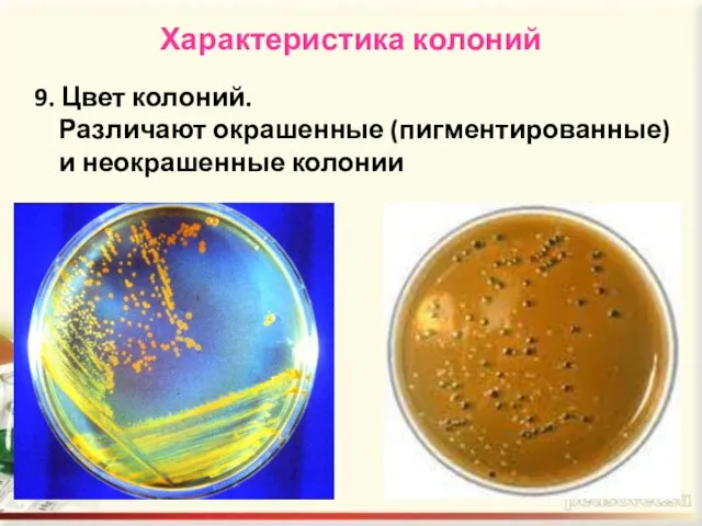 Характеристика колоний 9. Цвет колоний. Различают окрашенные (пигментированные) и неокрашенные колонии