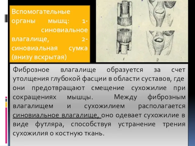 Вспомогательные органы мышц: 1- синовиальное влагалище, 2-синовиальная сумка (внизу вскрытая) Фиброзное влагалище