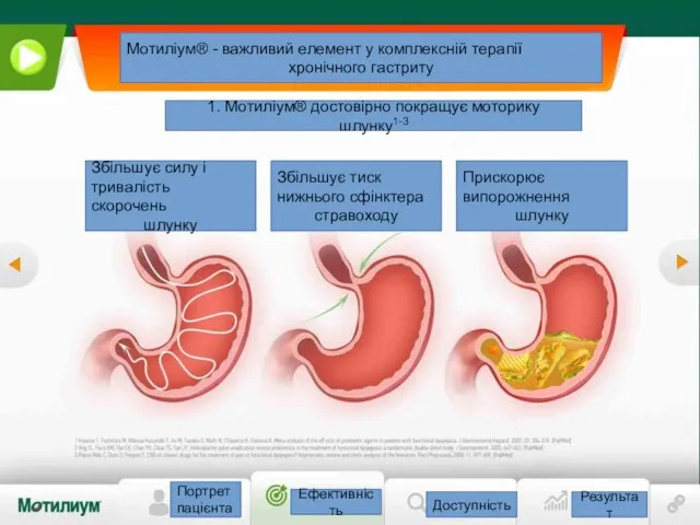 Портрет пацієнта Ефективність Доступність Результат Мотиліум® - важливий елемент у комплексній терапії