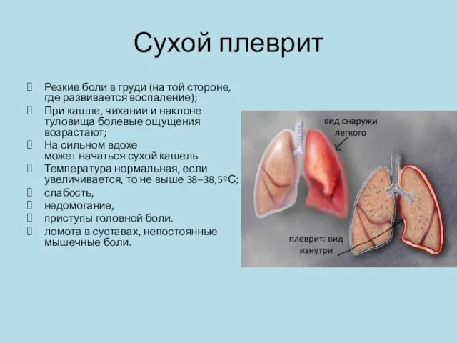 Сухой плеврит Резкие боли в груди (на той стороне, где развивается воспаление);