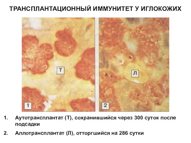 ТРАНСПЛАНТАЦИОННЫЙ ИММУНИТЕТ У ИГЛОКОЖИХ Аутотрансплантат (Т), сохранившийся через 300 суток после подсадки