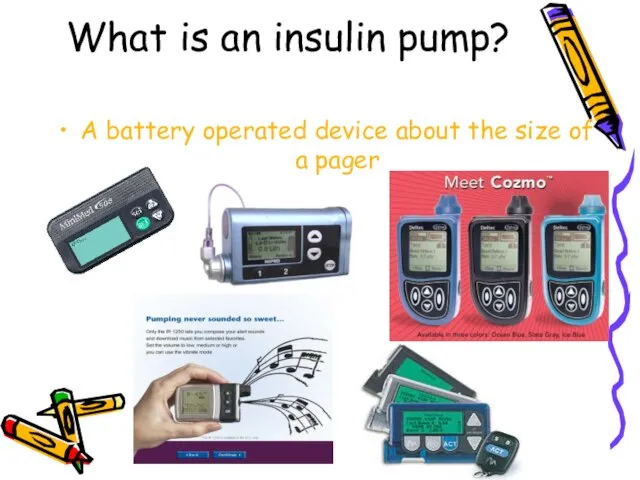 What is an insulin pump? A battery operated device about the size of a pager