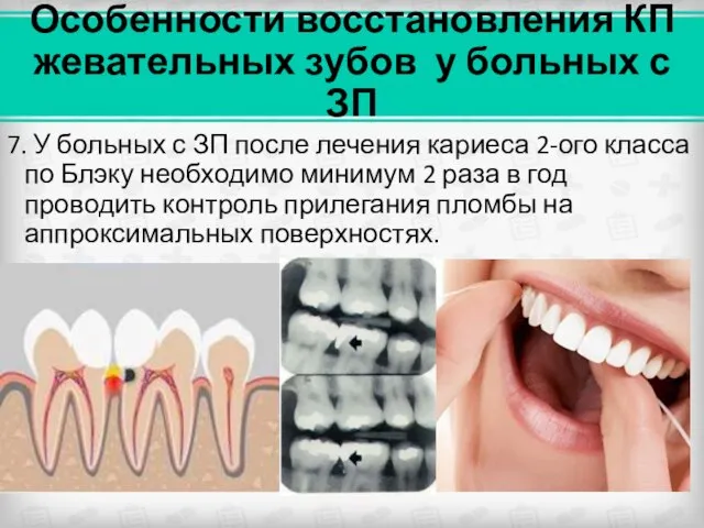 Особенности восстановления КП жевательных зубов у больных с ЗП 7. У больных