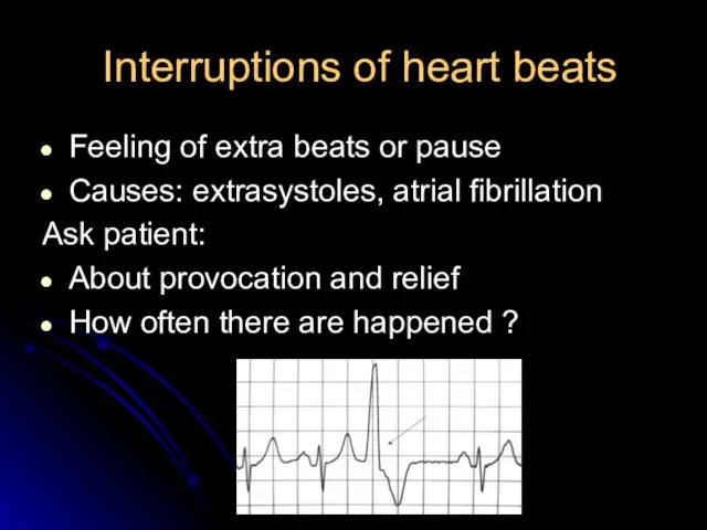 Interruptions of heart beats Feeling of extra beats or pause Causes: extrasystoles,