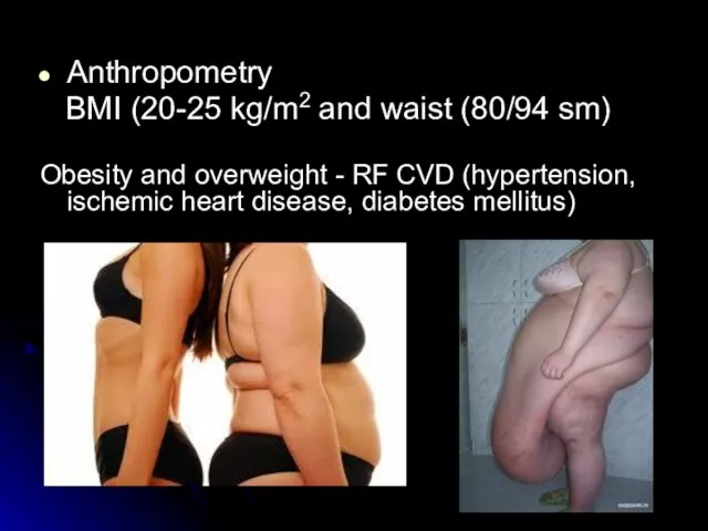 Anthropometry BMI (20-25 kg/m2 and waist (80/94 sm) Obesity and overweight -