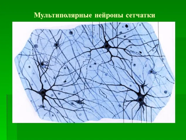 Мультиполярные нейроны сетчатки