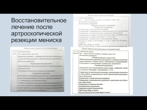 Восстановительное лечение после артроскопической резекции мениска