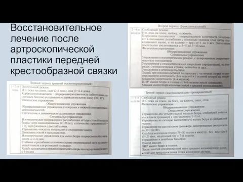 Восстановительное лечение после артроскопической пластики передней крестообразной связки