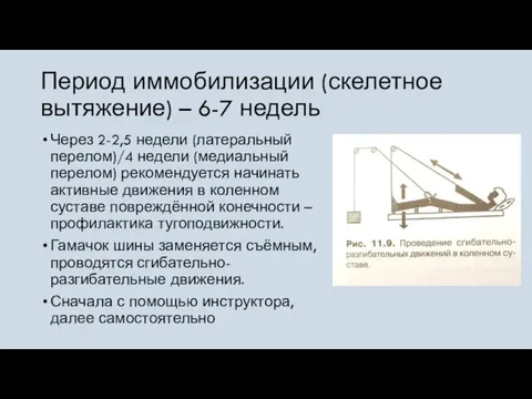 Период иммобилизации (скелетное вытяжение) – 6-7 недель Через 2-2,5 недели (латеральный перелом)/4