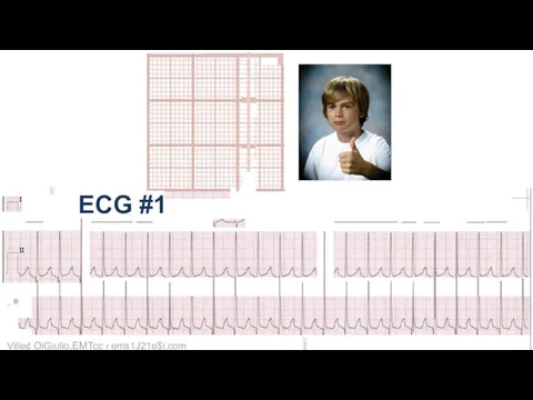 I ECG #1 _ Ill Ville¢ OiGiulio,EMTcc r ems1J21e$i.com I