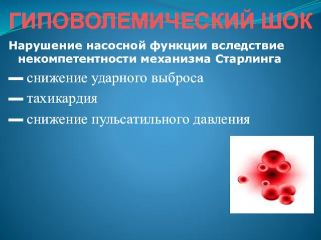 ГИПОВОЛЕМИЧЕСКИЙ ШОК Нарушение насосной функции вследствие некомпетентности механизма Старлинга ▬ снижение ударного