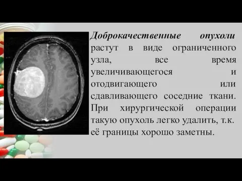 Доброкачественные опухоли растут в виде ограниченного узла, все время увеличивающегося и отодвигающего