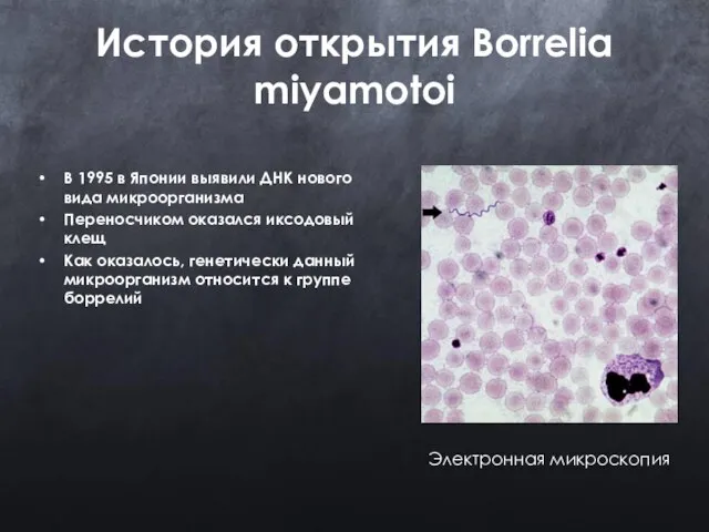 История открытия Borrelia miyamotoi В 1995 в Японии выявили ДНК нового вида