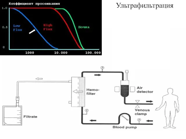 Ультрафильтрация