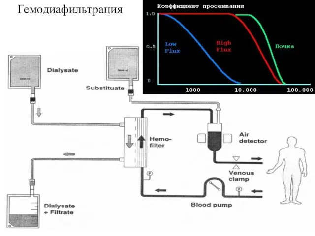 Гемодиафильтрация