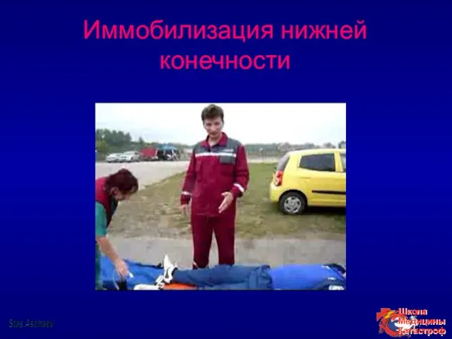 Иммобилизация нижней конечности Stas Aschaev