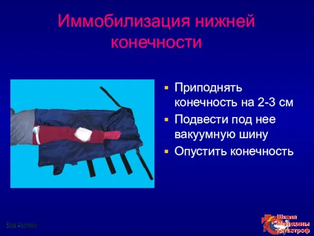 Иммобилизация нижней конечности Приподнять конечность на 2-3 см Подвести под нее вакуумную