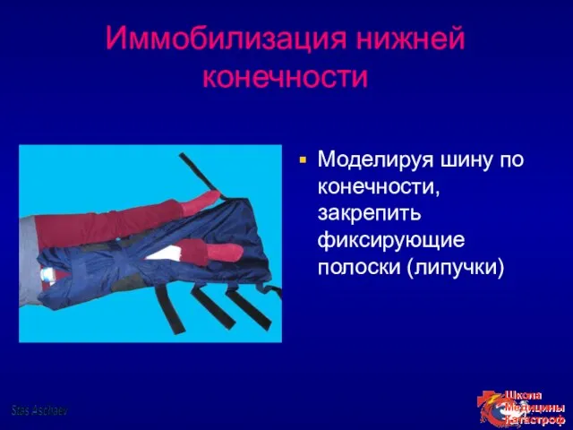 Иммобилизация нижней конечности Моделируя шину по конечности, закрепить фиксирующие полоски (липучки) Stas Aschaev
