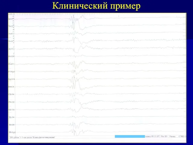 Клинический пример