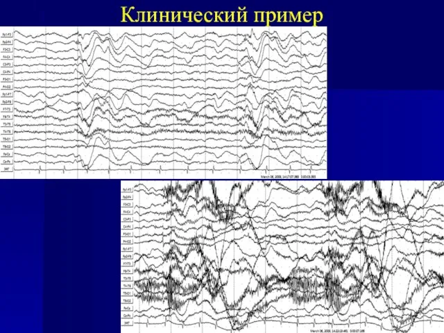 Клинический пример