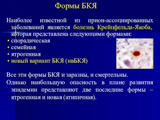 Наиболее известной из прион-ассоциированных заболеваний является болезнь Крейцфельда-Якоба, которая представлена следующими формами: