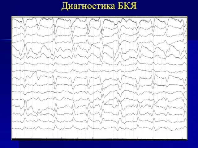 Диагностика БКЯ