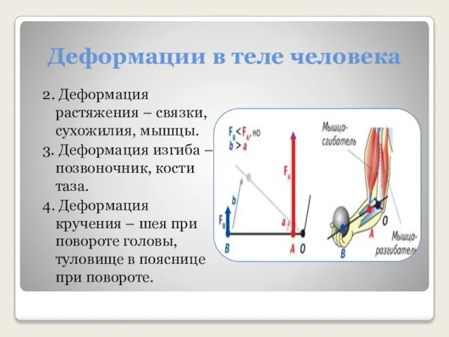 Деформации в теле человека 2. Деформация растяжения – связки, сухожилия, мышцы. 3.