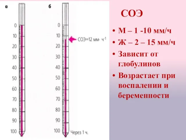 СОЭ М – 1 -10 мм/ч Ж – 2 – 15 мм/ч